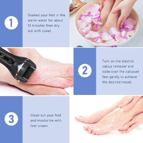 Removedor Profissional de Calos e Pele Dura para Pés: Ferramenta Elétrica de Pedicure para Lixar Calos, Calosidades e Pele Dura nos Calcanhares