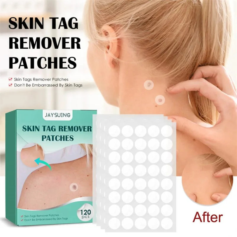 Facial verruga Tag removedor Patch, Acne Pimple Patches, Tag da pele, Mole adesivo, Reparação da pele, Antibacteriano Corn Plast, Cuidados com a pele, 120pcs