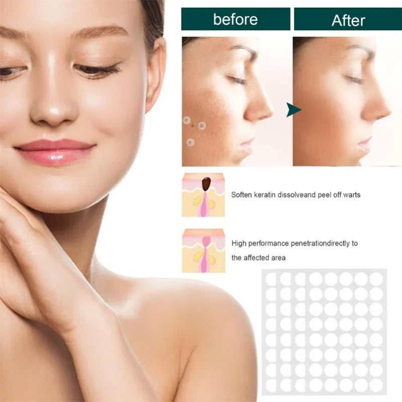 Facial verruga Tag removedor Patch, Acne Pimple Patches, Tag da pele, Mole adesivo, Reparação da pele, Antibacteriano Corn Plast, Cuidados com a pele, 120pcs