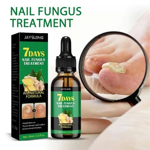 Funguss-Solução Unha Cuidado, Óleo De Paroníquia, Tratamento Unha Ingrown, Essência Reparação De Unhas, Feito com Gengibre